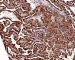 Galectin 3 Antibody in Immunohistochemistry (Paraffin) (IHC (P))