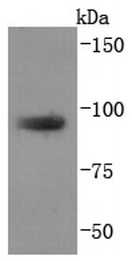 TGN46 Antibody in Western Blot (WB)