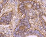 CD147 Antibody in Immunohistochemistry (Paraffin) (IHC (P))