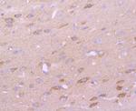 CD147 Antibody in Immunohistochemistry (Paraffin) (IHC (P))