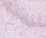 CD147 Antibody in Immunohistochemistry (Paraffin) (IHC (P))