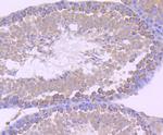 CD147 Antibody in Immunohistochemistry (Paraffin) (IHC (P))