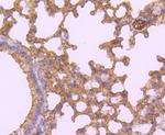 WFDC2 Antibody in Immunohistochemistry (Paraffin) (IHC (P))