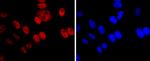 DNMT1 Antibody in Immunocytochemistry (ICC/IF)