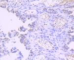 DNMT1 Antibody in Immunohistochemistry (Paraffin) (IHC (P))