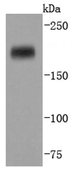 DNMT1 Antibody in Western Blot (WB)