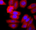 Neutrophil elastase Antibody in Immunocytochemistry (ICC/IF)