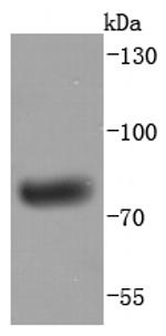 Human IgM Antibody in Western Blot (WB)