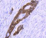 S100P Antibody in Immunohistochemistry (Paraffin) (IHC (P))