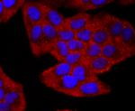 CD19 Antibody in Immunocytochemistry (ICC/IF)