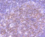 CD19 Antibody in Immunohistochemistry (Paraffin) (IHC (P))