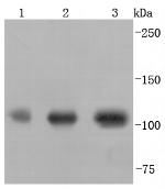 PGC1 alpha/beta Antibody in Western Blot (WB)