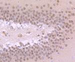 TBR1 Antibody in Immunohistochemistry (Paraffin) (IHC (P))