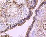 Thioredoxin 1 Antibody in Immunohistochemistry (Paraffin) (IHC (P))