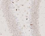 ADAM17 Antibody in Immunohistochemistry (Paraffin) (IHC (P))