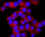 Ub-K63 Antibody in Immunocytochemistry (ICC/IF)