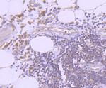 Ub-K63 Antibody in Immunohistochemistry (Paraffin) (IHC (P))