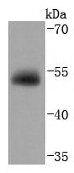 GC Antibody in Western Blot (WB)