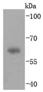 Human IgA Antibody in Western Blot (WB)