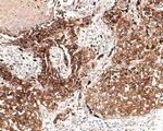 Neural/Glial Antigen 2 (NG2) Antibody in Immunohistochemistry (Paraffin) (IHC (P))