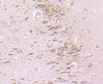 Neural/Glial Antigen 2 (NG2) Antibody in Immunohistochemistry (Paraffin) (IHC (P))