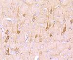 Neural/Glial Antigen 2 (NG2) Antibody in Immunohistochemistry (Paraffin) (IHC (P))