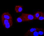 ERCC1 Antibody in Immunocytochemistry (ICC/IF)