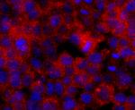 ERCC1 Antibody in Immunocytochemistry (ICC/IF)