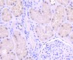 ERCC1 Antibody in Immunohistochemistry (Paraffin) (IHC (P))