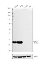 PGP9.5 Antibody in Western Blot (WB)