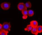 PGP9.5 Antibody in Immunocytochemistry (ICC/IF)