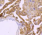 Haptoglobin Antibody in Immunohistochemistry (Paraffin) (IHC (P))