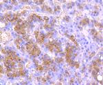 Urokinase Antibody in Immunohistochemistry (Paraffin) (IHC (P))