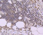 Urokinase Antibody in Immunohistochemistry (Paraffin) (IHC (P))