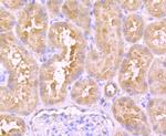 Urokinase Antibody in Immunohistochemistry (Paraffin) (IHC (P))