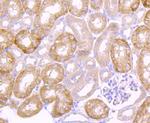 Urokinase Antibody in Immunohistochemistry (Paraffin) (IHC (P))