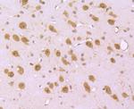 S1P1 Antibody in Immunohistochemistry (Paraffin) (IHC (P))