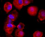 CD59 (Protectin) Antibody in Immunocytochemistry (ICC/IF)
