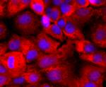 CD59 (Protectin) Antibody in Immunocytochemistry (ICC/IF)