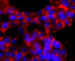 ATP Synthase beta Antibody in Immunocytochemistry (ICC/IF)