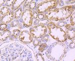 ATP Synthase beta Antibody in Immunohistochemistry (Paraffin) (IHC (P))