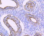 ATP Synthase beta Antibody in Immunohistochemistry (Paraffin) (IHC (P))