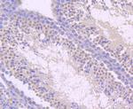 TLR5 Antibody in Immunohistochemistry (Paraffin) (IHC (P))