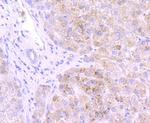 GBA Antibody in Immunohistochemistry (Paraffin) (IHC (P))