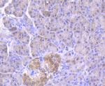 GBA Antibody in Immunohistochemistry (Paraffin) (IHC (P))