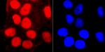 SMC3 Antibody in Immunocytochemistry (ICC/IF)