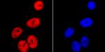 SMC3 Antibody in Immunocytochemistry (ICC/IF)