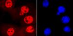 SMC3 Antibody in Immunocytochemistry (ICC/IF)