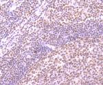 SMC3 Antibody in Immunohistochemistry (Paraffin) (IHC (P))