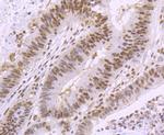 SMC3 Antibody in Immunohistochemistry (Paraffin) (IHC (P))